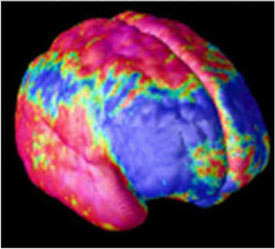 Brain Imaging