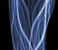 Igniting Technology