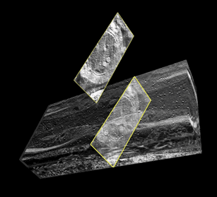 BIRN visualization