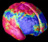 Brain Image