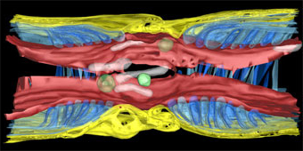 3D Tomography