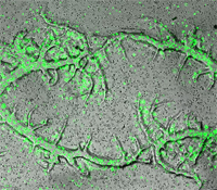 Stem Cell Awards to Two UC San Diego Researchers
