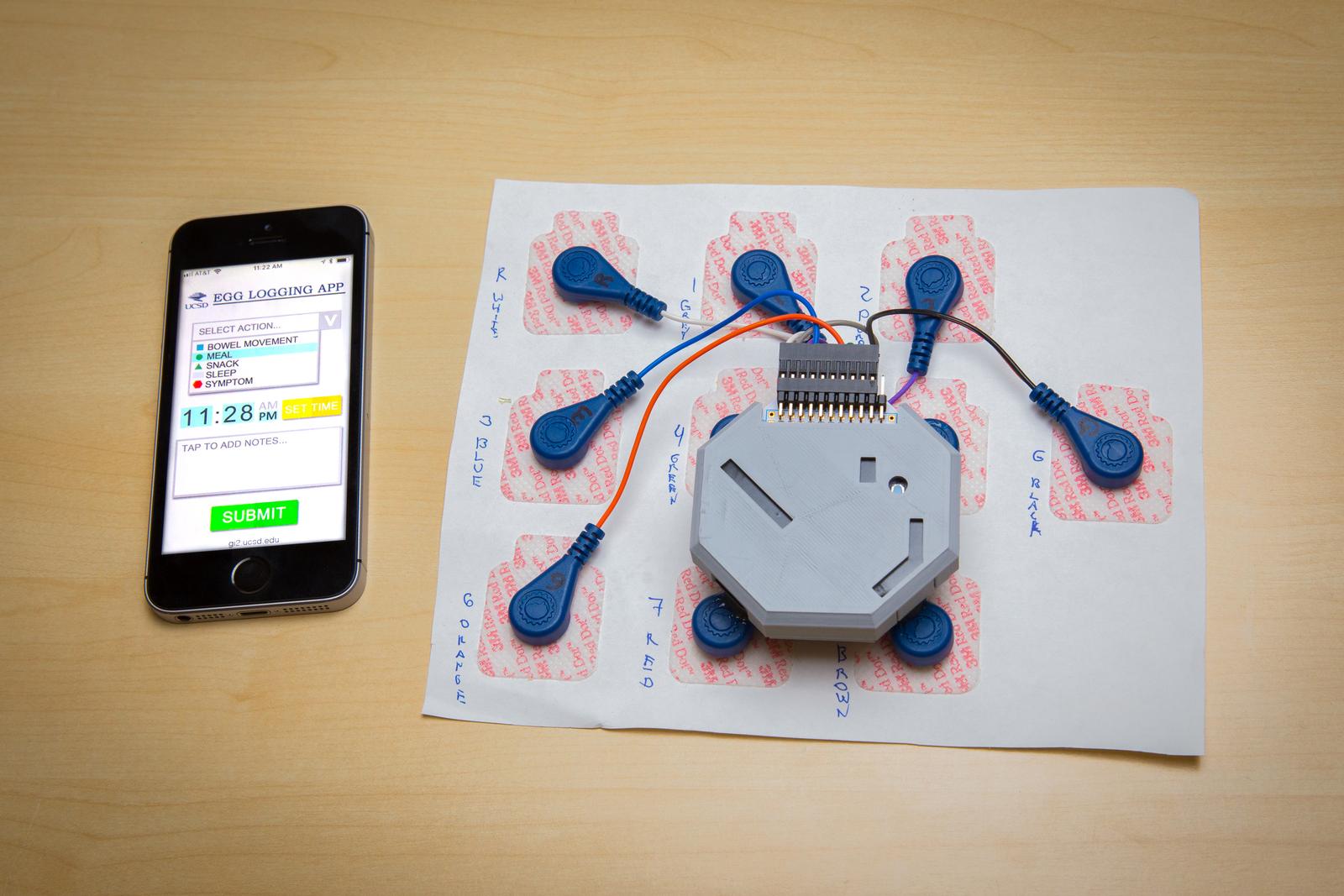 The system and its accompanying app.