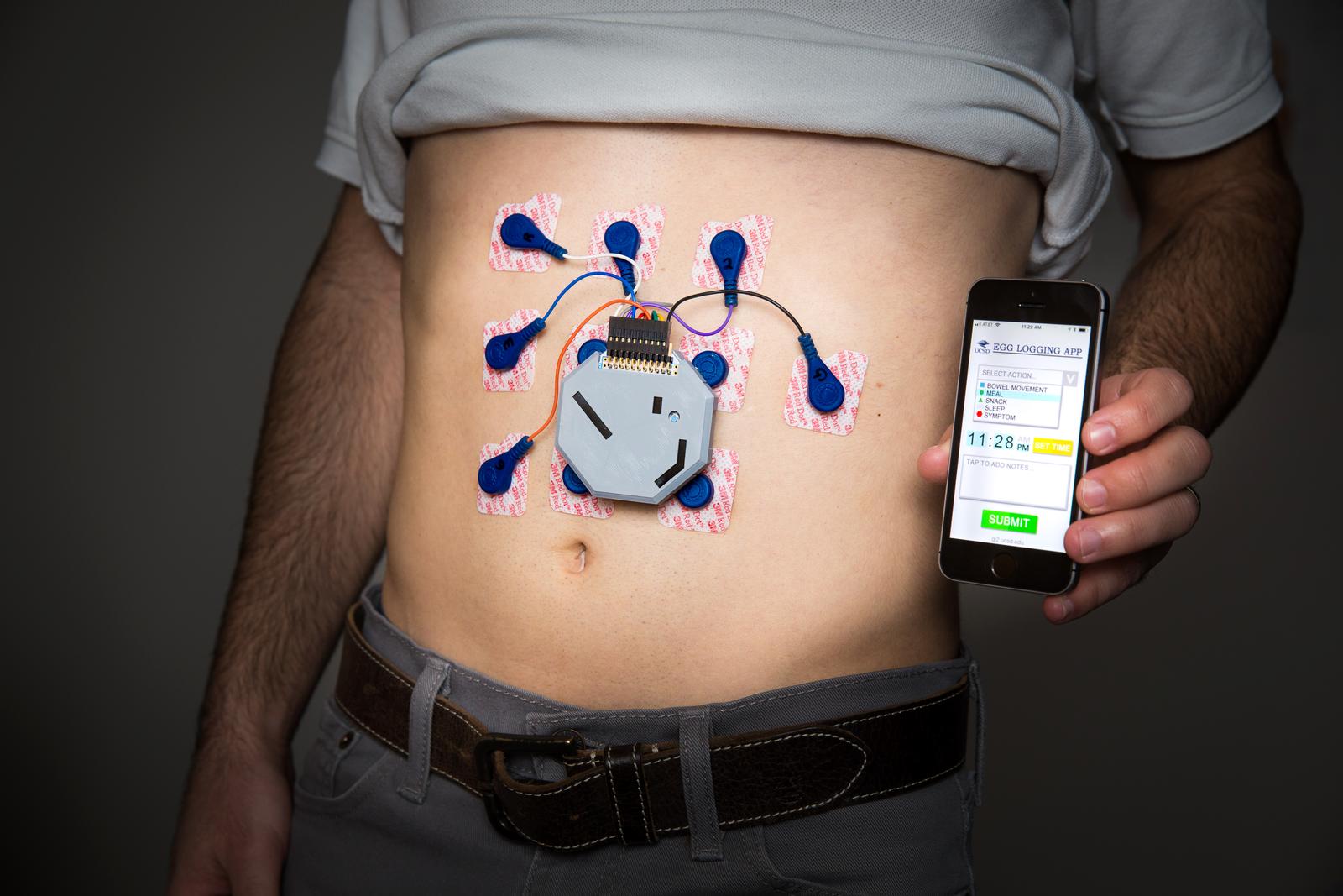 Researchers have developed a wearable system to monitor stomach activity that performs as well as current state of the art methods but can be used outside of a clinical setting. The system also comes with an app that allows patients to log their meals, sleep and other activities.