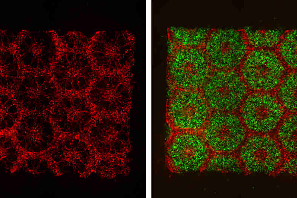 Images of the 3D-printed parts of the biomimetic liver tissue: