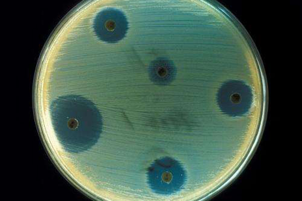 antibiotic candidates could be found through a new technique for screening peptidic natural products