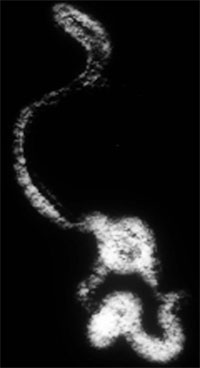 Pictogram of data shown above