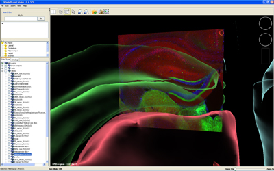 WBC interface