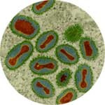 smallpox